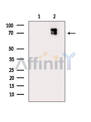 AMPK alpha Mouse Monoclonal Antibody - Western blot analysis of extracts from Mouse muscle, using AMPK alpha Mouse Monoclonal Antibody.