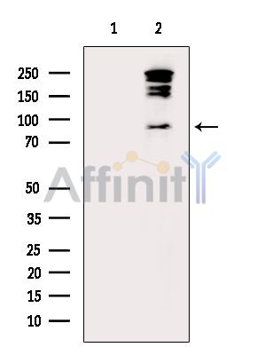 NR3C1 Mouse Monoclonal Antibody - Western blot analysis of extracts from B16F10-LUC cells, using NR3C1 Mouse Monoclonal Antibody.