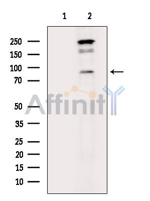 NR3C1 Mouse Monoclonal Antibody - Western blot analysis of extracts from EC304 cells, using NR3C1 Mouse Monoclonal Antibody.