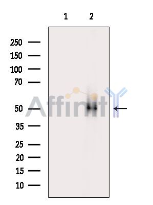 hnRNP C1/C2 Mouse Monoclonal Antibody - Western blot analysis of extracts from Rat testis, using hnRNP C1/C2 Mouse Monoclonal Antibody.