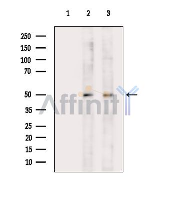 hnRNP C1/C2 Mouse Monoclonal Antibody - Western blot analysis of extracts from various samples, using hnRNP C1/C2 Mouse Monoclonal Antibody.