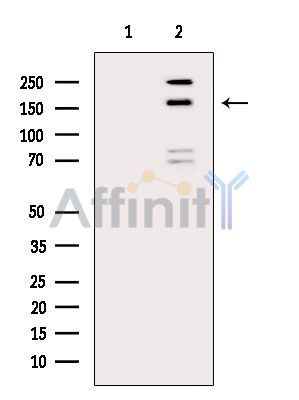 NRAP Antibody - Western blot analysis of extracts from COLO205 cells(heat-shock treatment), using NRAP Antibody.