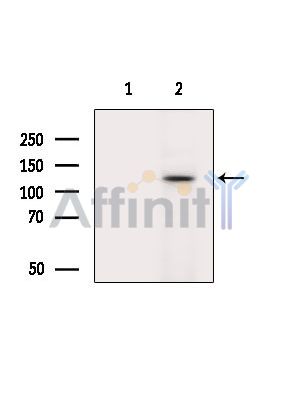 Liprin alpha 2 Antibody - Western blot analysis of extracts from Rat brain, using Liprin alpha 2 Antibody.