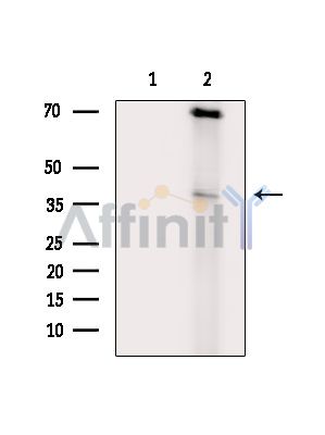 LRRC67 Antibody - Western blot analysis of extracts from EC304 cells(heat-shock treatment), using LRRC67 Antibody.