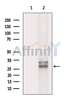 CLEC1B Antibody - Western blot analysis of extracts from Mouse testis, using CLEC1B Antibody.