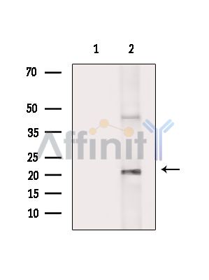 SYNGR1 Antibody - Western blot analysis of extracts from Rat brain, using SYNGR1 Antibody.