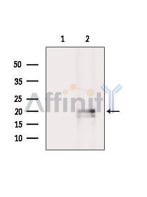 HMGB4 Antibody - Western blot analysis of extracts from Rat brain, using HMGB4 Antibody.