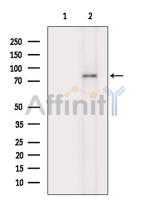 CCSER1 Antibody - Western blot analysis of extracts from Rat brain, using CCSER1 Antibody.