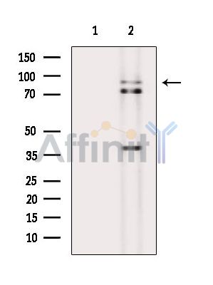 PHEX Antibody - Western blot analysis of extracts from EC304 cells(heat-shock treatment), using PHEX Antibody.