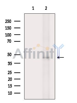 TMLHE Antibody - Western blot analysis of extracts from Rat brain, using TMLHE Antibody.