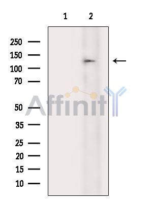 ZNF687 Antibody - Western blot analysis of extracts from EC304 cells(heat-shock treatment), using ZNF687 Antibody.