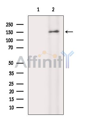 DENND5A Antibody - Western blot analysis of extracts from Rat brain, using DENND5A Antibody.