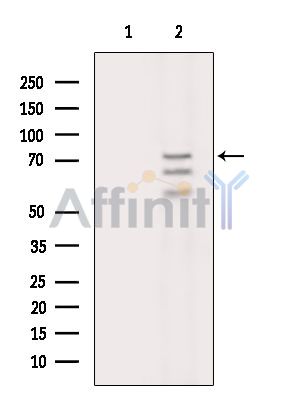 LZTS3 Antibody - Western blot analysis of extracts from Rat brain, using LZTS3 Antibody.