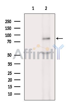 ADAM22 Antibody - Western blot analysis of extracts from COLO205 cells(heat-shock treatment), using ADAM22 Antibody.