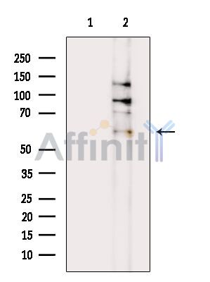 B3GALNT2 Antibody - Western blot analysis of extracts from COLO205 cells(heat-shock treatment), using B3GALNT2 Antibody.