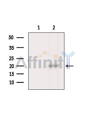 JOSD2 Antibody - Western blot analysis of extracts from Rat brain, using JOSD2 Antibody.