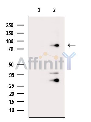 ESPN Antibody - Western blot analysis of extracts from COLO205 cells(heat-shock treatment), using ESPN Antibody.
