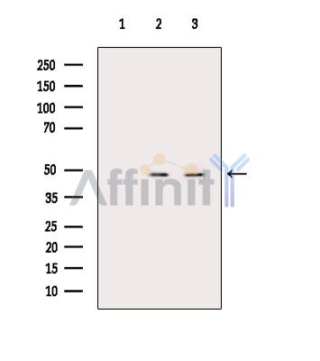 ASB4 Antibody - Western blot analysis of extracts from COLO205 cells(heat-shock treatment), using ASB4 Antibody.