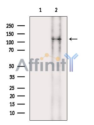 LMTK3 Antibody - Western blot analysis of extracts from rat brain, using LMTK3 Antibody.