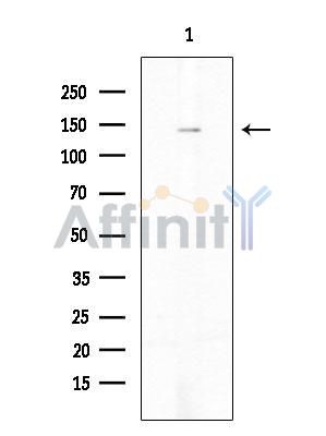 c-Kit Mouse Monoclonal Antibody - Western blot analysis of extracts from COLO205 cells(heat-shock treatment), using c-Kit Mouse Monoclonal Antibody.