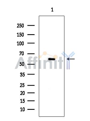 PKM2 Mouse Monoclonal Antibody - Western blot analysis of extracts from Rat heart, using PKM2 Mouse Monoclonal Antibody at 1/1000 dilution.