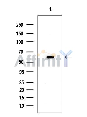PKM2 Mouse Monoclonal Antibody - Western blot analysis of extracts from Mouse heart, using PKM2 Mouse Monoclonal Antibody at 1/1000 dilution.