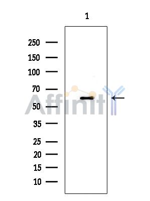 PKM2 Mouse Monoclonal Antibody - Western blot analysis of extracts from 293 cells(serum starvation treatment), using PKM2 Mouse Monoclonal Antibody at 1/1000 dilution.