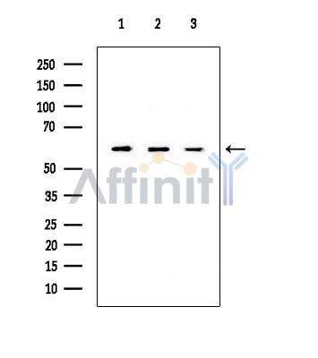 PKM2 Mouse Monoclonal Antibody - Western blot analysis of extracts from various samples, using PKM2 Mouse Monoclonal Antibody at 1/1000 dilution.