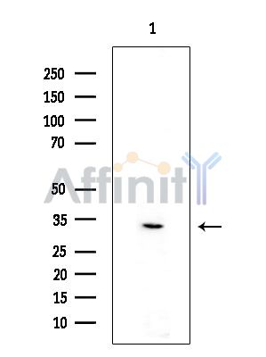 ZNF364 Antibody - Western blot analysis of extracts from Rat brain, using ZNF364 Antibody at 1/1000 dilution.