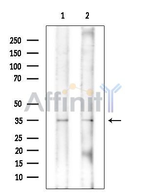 STOML3 Antibody - Western blot analysis of extracts from various samples, using STOML3 Antibody at 1/1000 dilution.