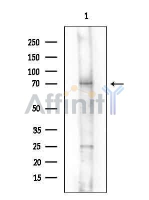 KPNA6 Antibody - Western blot analysis of extracts from Rat brain, using KPNA6 Antibody at 1/1000 dilution.