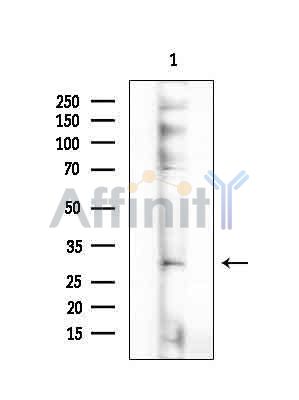 PLAC1 Antibody - Western blot analysis of extracts from COLO205 cells(heat-shock treatment), using PLAC1 Antibody at 1/1000 dilution.