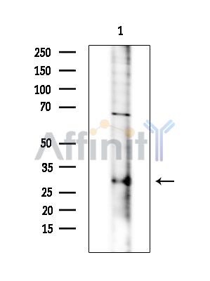 KCTD15 Antibody - Western blot analysis of extracts from COLO205 cells(heat-shock treatment), using KCTD15 Antibody at 1/1000 dilution.