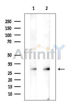 CLEC12A Antibody - Western blot analysis of extracts from various samples, using CLEC12A Antibody at 1/1000 dilution.