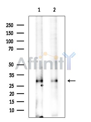 TPD52 Antibody - Western blot analysis of extracts from various samples, using TPD52 Antibody.