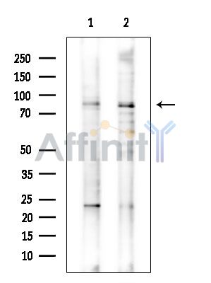 FBXO30 Antibody - Western blot analysis of extracts from various samples, using FBXO30 Antibody.