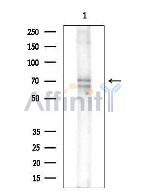 TGM3 Antibody - Western blot analysis of extracts from Rat brain, using TGM3 Antibody at 1/1000 dilution.