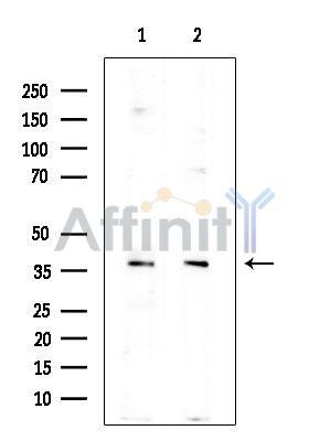 VSIG4 Antibody - Western blot analysis of extracts from various samples, using VSIG4 Antibody at 1/1000 dilution.