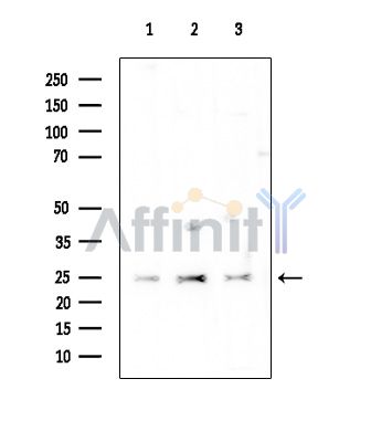 EMP3 Antibody - Western blot analysis of extracts from various samples, using EMP3 Antibody at 1/1000 dilution.