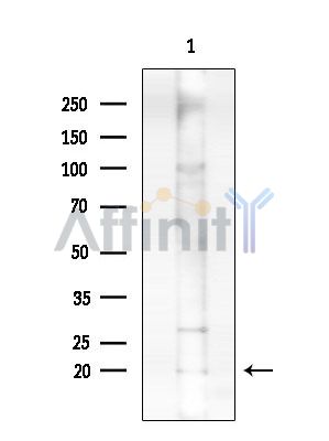 NENF Antibody - Western blot analysis of extracts from Rat brain, using NENF Antibody at 1/1000 dilution.