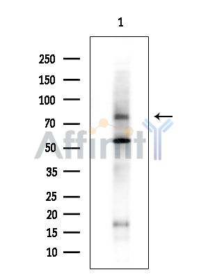 SLC15A2 Antibody - Western blot analysis of extracts from COLO205 cells(heat-shock treatment), using SLC15A2 Antibody.