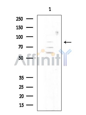 CCDC170 Antibody - Western blot analysis of extracts from COLO205 cells(heat-shock treatment), using CCDC170 Antibody at 1/1000 dilution.