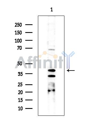 SIGIRR Antibody - Western blot analysis of extracts from COLO205 cells(heat-shock treatment), using SIGIRR Antibody at 1/1000 dilution.