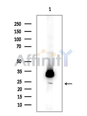 UBE2G2 Antibody - Western blot analysis of extracts from Rat brain, using UBE2G2 Antibody.