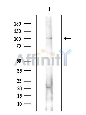 CAPN15 Antibody - Western blot analysis of extracts from COLO205 cells(heat-shock treatment), using CAPN15 Antibody.