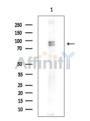 SLITRK4 Antibody - Western blot analysis of extracts from Rat brain, using SLITRK4 Antibody.