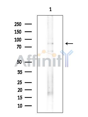 SLITRK4 Antibody - Western blot analysis of extracts from Mouse testis, using SLITRK4 Antibody.
