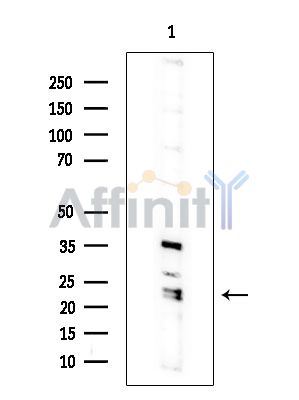 DNAJC24 Antibody - Western blot analysis of extracts from COLO205 cells(heat-shock treatment), using DNAJC24 Antibody.