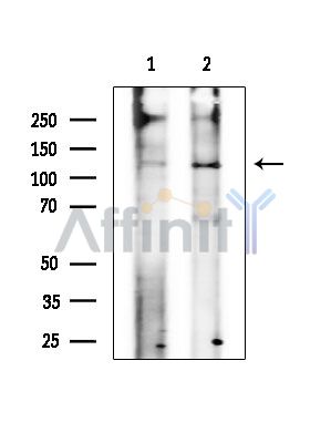 NAA25 Antibody - Western blot analysis of extracts from various samples, using NAA25 Antibody at 1/1000 dilution.