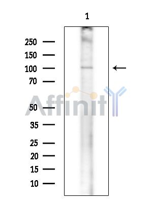 NAA25 Antibody - Western blot analysis of extracts from COLO205 cells(heat-shock treatment), using NAA25 Antibody at 1/1000 dilution.